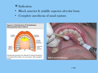 1 /1031 /103
 Indication
• Block anterior & middle superior alveolar bone
• Complete anesthesia of nasal septum
 