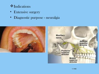 1 /1031 /103
Indications
• Extensive surgery
• Diagnostic purpose - neuralgia
 