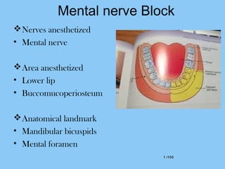 1 /1031 /103
Mental nerve Block
Nerves anesthetized
• Mental nerve
Area anesthetized
• Lower lip
• Buccomucoperiosteum
Anatomical landmark
• Mandibular bicuspids
• Mental foramen
 