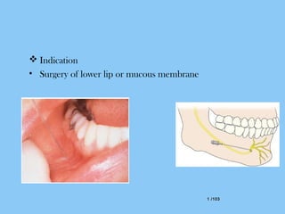 1 /1031 /103
 Indication
• Surgery of lower lip or mucous membrane
 