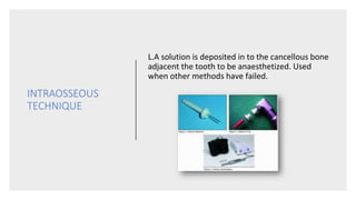 INTRAOSSEOUS
TECHNIQUE
L.A solution is deposited in to the cancellous bone
adjacent the tooth to be anaesthetized. Used
when other methods have failed.
 