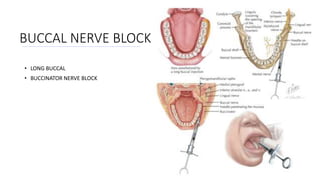 • LONG BUCCAL
• BUCCINATOR NERVE BLOCK
BUCCAL NERVE BLOCK
 