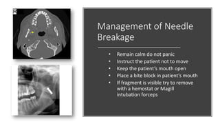 Management of Needle
Breakage
• Remain calm do not panic
• Instruct the patient not to move
• Keep the patient’s mouth open
• Place a bite block in patient’s mouth
• If fragment is visible try to remove
with a hemostat or Magill
intubation forceps
 