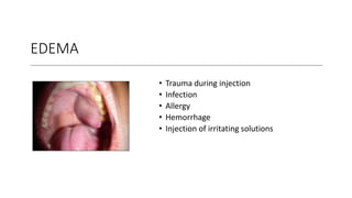 EDEMA
• Trauma during injection
• Infection
• Allergy
• Hemorrhage
• Injection of irritating solutions
 