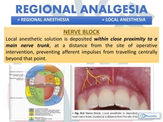 REGIONAL ANALGESIA
= REGIONAL ANESTHESIA = LOCAL ANESTHESIA
NERVE BLOCK
Local anesthetic solution is deposited within close proximity to a
main nerve trunk, at a distance from the site of operative
intervention, preventing afferent impulses from travelling centrally
beyond that point.
 