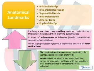 • Infraorbital Ridge
• Infraorbital Depression
• Supraorbital Notch
• Infraorbital Notch
• Anterior teeth
• Pupils of the Eye
Anatomical
Landmarks
Involving more than two maxillary anterior teeth (incisors
through premolars) and their overlying buccal tissues.
In cases of inflammation or infection (which contraindicates
supraperiosteal injection)
When supraperiosteal injection is ineffective because of dense
cortical bone.
Discrete treatment areas (one or two teeth only;
supraperiosteal injection preferred).
Hemostasis of localized areas, when desirable,
cannot be adequately achieved with this injection;
local infiltration into the treatment area is
indicated. 
 