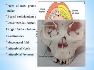 *Pulps of max. premolar and mesiobuccal root of the 1st
molar
*Buccal periodontium and bone
*Lower eye, lat. Aspect of nose, upper lip
Target Area – Infraorbital Foramen
Landmarks
*Mucobuccal fold
*Infraorbital Notch
*Infraorbital Foramen
 