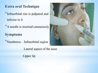 Extra oral Technique
*Infraorbital rim is palpated and infraorbital depression is felt 1cm
inferior to it
*A needle is inserted cutaneously near the foramen
Symptoms
*Numbness – Infraorbital region
Lateral aspect of the nose
Upper lip
 
