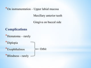*On instrumentation – Upper labial mucosa
Maxillary anterior teeth
Gingiva on buccal side
Complications
*Hematoma – rarely
*Diplopia
*Exophthalmos
*Blindness - rarely
Orbit
 