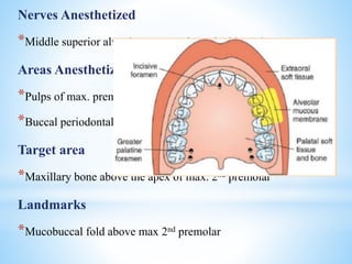 Nerves Anesthetized
*Middle superior alveolar nerve and terminal branches
Areas Anesthetized
*Pulps of max. premolars, mesiobuccal root of max.1st molar
*Buccal periodontal tissues and bone
Target area
*Maxillary bone above the apex of max. 2nd premolar
Landmarks
*Mucobuccal fold above max 2nd premolar
 