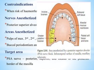 Contraindications
*When risk of haemorrhage is too great
Nerves Anesthetized
*Posterior superior alveolar nerve and its branches
Areas Anesthetized
*Pulps of max. 3rd , 2nd , and 1st molars
*Buccal periodontium and bone
Target area
*PSA nerve – posterior, superior, and medial to the posterior
border of the maxilla
 