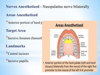 Nerves Anesthetized - Nasopalatine nerve bilaterally
Areas Anesthetized
*Anterior portion of hard palate bilaterally
Target Area
*Incisive foramen (beneath incisive papilla)
Landmarks
*Central incisors
*Incisive papilla
 