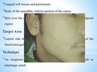*Lingual soft tissues and periosteum
*Body of the mandible, inferior portion of the ramus
*Skin over the zygoma, posterior portion of the cheek, and temporal
region
Target Area
*Lateral side of the condylar neck, just below the insertion of the
lateral pterygoid muscle
Technique
*An imaginary line is drawn from the corner of the mouth to
intertragic notch
 