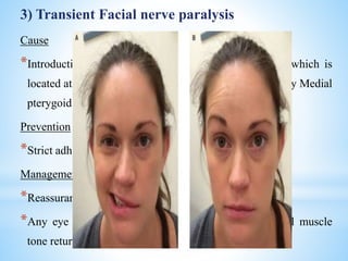 3) Transient Facial nerve paralysis
Cause
*Introduction of LA into the capsule of parotid gland which is
located at posterior border of the mand. ramus, clothed by Medial
pterygoid and masseter
Prevention
*Strict adherence to injection protocol and proper care
Management
*Reassurance of the patient
*Any eye patch should be applied to affected eye until muscle
tone returns
 
