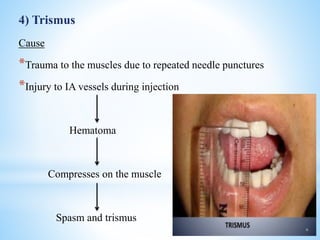 4) Trismus
Cause
*Trauma to the muscles due to repeated needle punctures
*Injury to IA vessels during injection
Hematoma
Compresses on the muscle
Spasm and trismus
 
