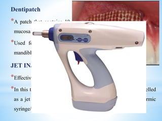 Dentipatch
*A patch that contains 10-20% lidocaine is placed on the dried
mucosa for 15 minutes
*Used for achieving topical anesthesia for both maxilla and
mandible
JET INJECTION
*Effective for palatal injection
*In this technique, a small amount of local anesthetic is propelled
as a jet into the sub – mucosa without the use of a hypodermic
syringe/ needle from a reservoir
 