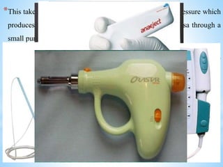 *This takes place when the knob is pressed to release air pressure which
produces a fine jet of solution which penetrates the mucosa through a
small puncture wound to produce surface anesthesia
COMPUTER CONTROLLED LOCAL ANESTHESIA
DELIVERY SYSTEM (C-CLAD)
*Milestone scientific – introduced the first C-CLAD System in 1997
and was termed the “WAND” and subsequent versions renamed as
“WAND PLUS” and “COMPUDENT”
*In 2001, DENTSPLY International introduced the Comfort Control
Syringe, Anaeject and Orastar from Japan
 