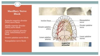 Maxillary Nerve
Block
Posterior superior alveolar
[PSA] nerve block
Middle superior alveolar
[MSA] nerve block
Anterior superior alveolar
[ASA, infraorbital] nerve
block
Greater palatine nerve block
Nasopalatine nerve block
 