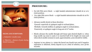 SIGNS AND SYMPTOMS:
1. Subjective: usually none.
2. Objective: absence of pain during
dental treatment.
PROCEDURE:
 For left PSA nerve block – a right handed administrator should sit at 10’o
clock position.
 For right PSA nerve block – a right handed administrator should sit at 8’o
clock position.
 Advance needle slowly in these direction:
Upward- superiorly at 45degree angle to occlusal plane,
Medially- towards midline at 45degree angle to occlusal plane,
Posteriorly- at 45degree angle to long axis of 2nd molar.
 Slowly advance the needle through soft tissue upto desired depth i.e. when
long needle (32 mm) is used, it is inserted half of its length (16 mm) and
when short needle (20mm) is used, approximately 4 mm should be visible.
 Aspirate in two planes i.e. rotate the barrel one fourth turn and if negative
aspiration is obtained, slowly deposit 0.9 to 1.8ml of solution, over 30-60
seconds.
 