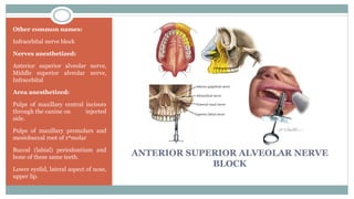 ANTERIOR SUPERIOR ALVEOLAR NERVE
BLOCK
Other common names:
Infraorbital nerve block
Nerves anesthetized:
Anterior superior alveolar nerve,
Middle superior alveolar nerve,
Infraorbital
Area anesthetized:
Pulps of maxillary central incisors
through the canine on injected
side.
Pulps of maxillary premolars and
mesiobuccal root of 1stmolar
Buccal (labial) periodontium and
bone of these same teeth.
Lower eyelid, lateral aspect of nose,
upper lip.
 