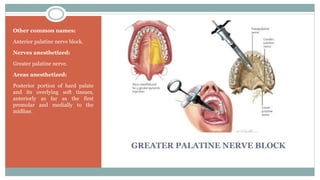 GREATER PALATINE NERVE BLOCK
Other common names:
Anterior palatine nerve block.
Nerves anesthetized:
Greater palatine nerve.
Areas anesthetized:
Posterior portion of hard palate
and its overlying soft tissues,
anteriorly as far as the first
premolar and medially to the
midline.
 