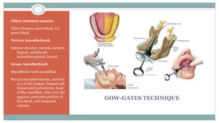 GOW-GATES TECHNIQUE
Other common names:
Third division nerve block, V3
nerve block
Nerves Anesthetized:
Inferior alveolar, mental, incisive,
lingual, mylohyoid,
auriculotemporal, buccal.
Areas Anesthetized:
Mandibular teeth to midline
Buccal mucoperiosteum, anterior
2/3 of the tongue, lingual soft
tissues and periosteum, body
of the mandible, skin over the
zygoma, posterior portion of
the cheek, and temporal
regions.
 