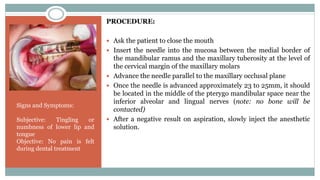 PROCEDURE:
 Ask the patient to close the mouth
 Insert the needle into the mucosa between the medial border of
the mandibular ramus and the maxillary tuberosity at the level of
the cervical margin of the maxillary molars
 Advance the needle parallel to the maxillary occlusal plane
 Once the needle is advanced approximately 23 to 25mm, it should
be located in the middle of the pterygo mandibular space near the
inferior alveolar and lingual nerves (note: no bone will be
contacted)
 After a negative result on aspiration, slowly inject the anesthetic
solution.
Signs and Symptoms:
Subjective: Tingling or
numbness of lower lip and
tongue
Objective: No pain is felt
during dental treatment
 