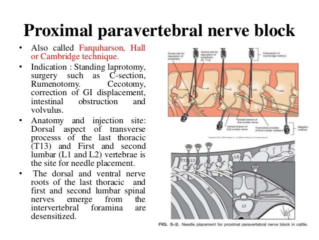 Local anesthesia and nerve blocks in large animals.