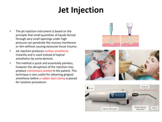 Jetco Ingection Local Anesthesia in childs , dentistry for adoleclsence | PPTX