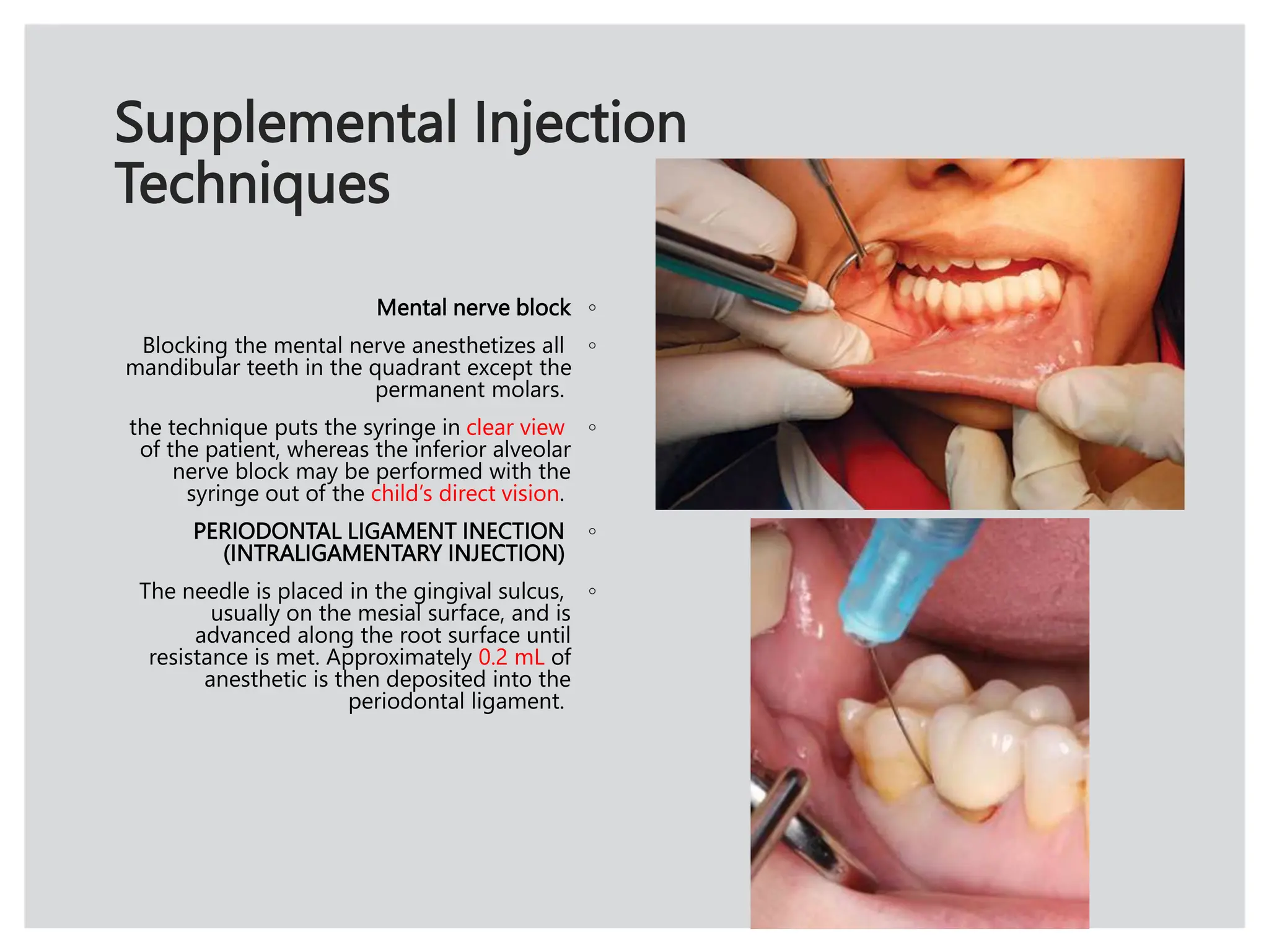 Local Anesthesia in childs [Autosaved].pptx
