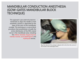 Local Anesthesia in childs [Autosaved].pptx