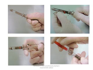 handbook of local anesthesia by stanley F.
malamed 6th edition
 