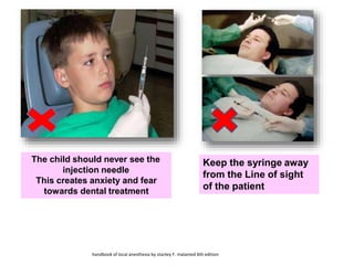 The child should never see the
injection needle
This creates anxiety and fear
towards dental treatment
Keep the syringe away
from the Line of sight
of the patient
handbook of local anesthesia by stanley F. malamed 6th edition
 