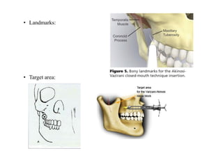 • Landmarks:
• Target area:
 