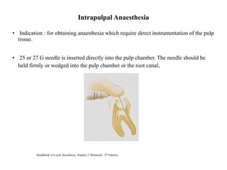 • Indication : for obtaining anaesthesia which require direct instrumentation of the pulp
tissue.
• 25 or 27 G needle is inserted directly into the pulp chamber. The needle should be
held firmly or wedged into the pulp chamber or the root canal.
Intrapulpal Anaesthesia
Handbook of Local Anesthesia. Stanley F Malamed. 5th Edition.
 
