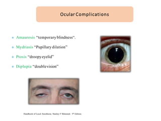 ❖ Amaurosis “temporary blindness“.
❖ Mydriasis “Pupillary dilation”
❖ Ptosis “droopyeyelid”
❖ Diplopia “doublevision”
Ocular Complications
Handbook of Local Anesthesia. Stanley F Malamed. 5th Edition.
 