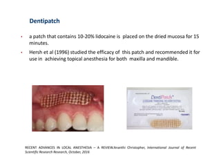 Dentipatch
• a patch that contains 10-20% lidocaine is placed on the dried mucosa for 15
minutes.
• Hersh et al (1996) studied the efficacy of this patch and recommended it for
use in achieving topical anesthesia for both maxilla and mandible.
RECENT ADVANCES IN LOCAL ANESTHESIA – A REVIEW.Ananthi Christopher, International Journal of Recent
Scientific Research Research, October, 2016
 