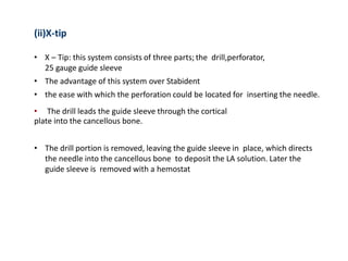 (ii)X-tip
• X – Tip: this system consists of three parts; the drill,perforator,
25 gauge guide sleeve
• The advantage of this system over Stabident
• the ease with which the perforation could be located for inserting the needle.
• The drill leads the guide sleeve through the cortical
plate into the cancellous bone.
• The drill portion is removed, leaving the guide sleeve in place, which directs
the needle into the cancellous bone to deposit the LA solution. Later the
guide sleeve is removed with a hemostat
 