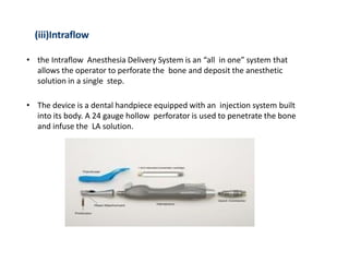 (iii)Intraflow
• the Intraflow Anesthesia Delivery System is an “all in one” system that
allows the operator to perforate the bone and deposit the anesthetic
solution in a single step.
• The device is a dental handpiece equipped with an injection system built
into its body. A 24 gauge hollow perforator is used to penetrate the bone
and infuse the LA solution.
 