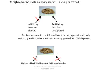 At high convulsive levels inhibitory neurons is entirely depressed ,
Brain
Inhibitory facilitatory
Impulse impulse
Blocked unopposed
Further increase in the L.A level leads to the depression of both
inhibitory and excitatory pathway causing generalized CNS depression
Blockage of both inhibitory and facilitatory impulse
handbook of local anesthesia by stanley F.
malamed 6th edition
 