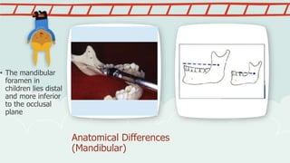 Anatomical Differences
(Mandibular)
• The mandibular
foramen in
children lies distal
and more inferior
to the occlusal
plane
 