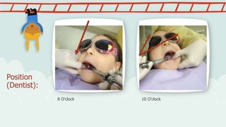 Position
(Dentist):
8 O’clock 10 O’clock
 