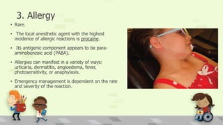 3. Allergy
• Rare.
• The local anesthetic agent with the highest
incidence of allergic reactions is procaine.
• Its antigenic component appears to be para-
aminobenzoic acid (PABA).
• Allergies can manifest in a variety of ways:
urticaria, dermatitis, angioedema, fever,
photosensitivity, or anaphylaxis.
• Emergency management is dependent on the rate
and severity of the reaction.
 