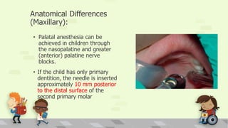 Anatomical Differences
(Maxillary):
• Palatal anesthesia can be
achieved in children through
the nasopalatine and greater
(anterior) palatine nerve
blocks.
• If the child has only primary
dentition, the needle is inserted
approximately 10 mm posterior
to the distal surface of the
second primary molar
 