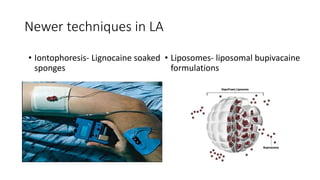 Newer techniques in LA
• Liposomes- liposomal bupivacaine
formulations
• Iontophoresis- Lignocaine soaked
sponges
 