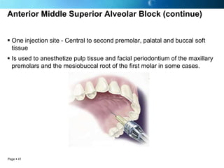 Anterior Middle Superior Alveolar Block (continue)


 One injection site - Central to second premolar, palatal and buccal soft
  tissue
 Is used to anesthetize pulp tissue and facial periodontium of the maxillary
  premolars and the mesiobuccal root of the first molar in some cases.




Page  41
 