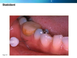 Stabident




Page  67
 