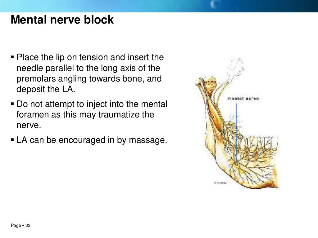 Local anesthesia techniques
