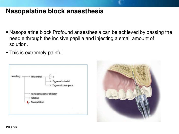 Local anesthesia techniques