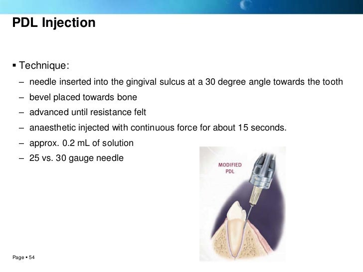 Local anesthesia techniques